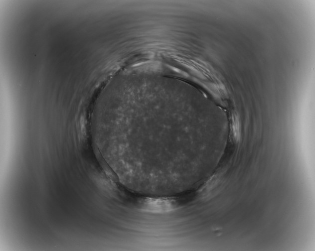 X0000085760520200704091337