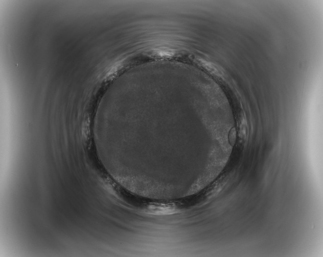 X0000085760559200704091336
