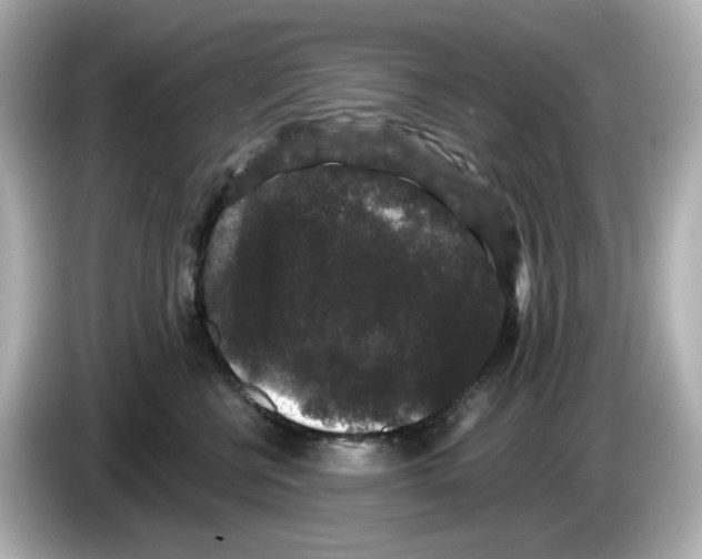 X0000085760570200704091336