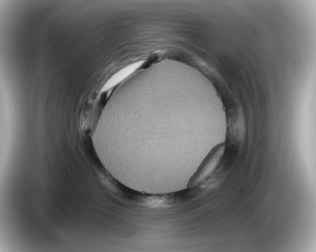 X0000085760574200704091336