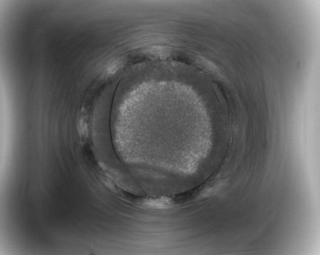X0000085760576200704091336