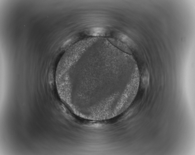 X0000085760620200704091335