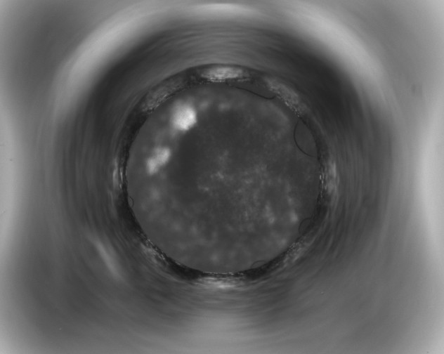 X0000085760763200704091334