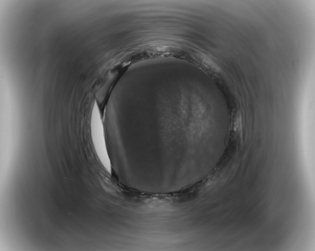 X0000085760868200704091332