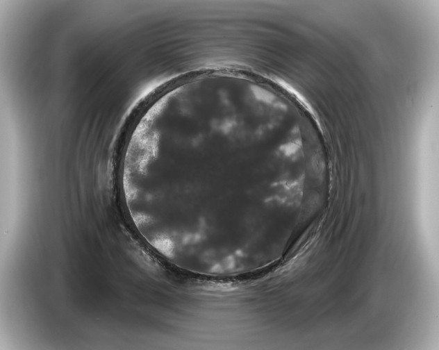 X0000085760975200704091331