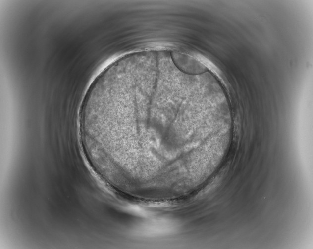 X0000085761047200704091331