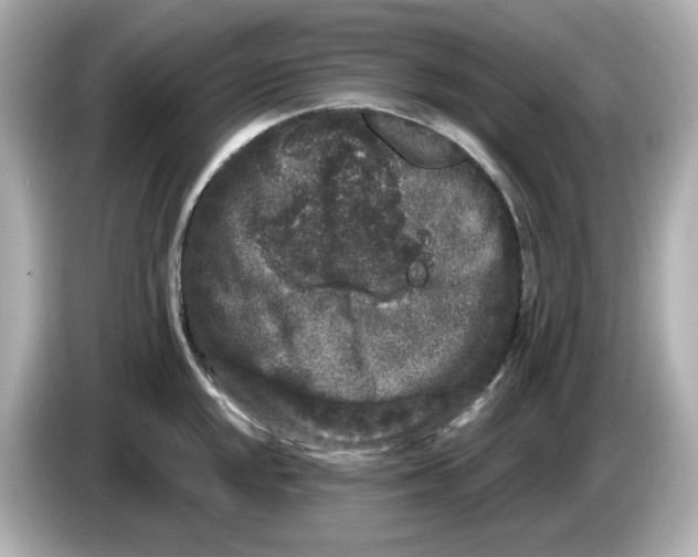 X0000085761048200704091331