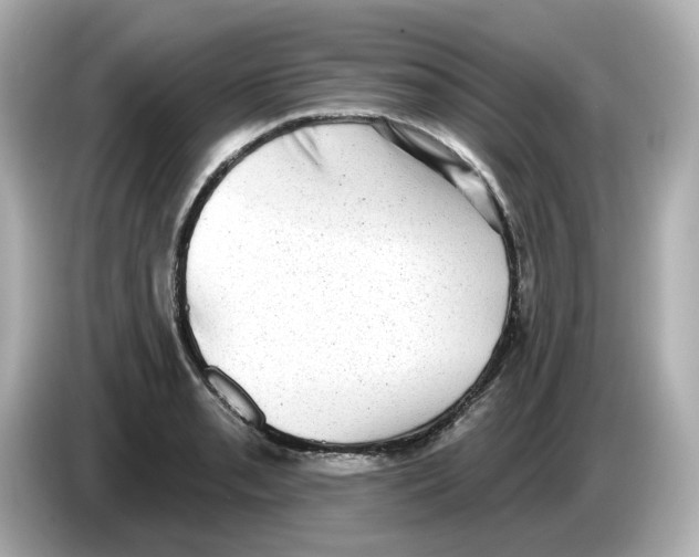 X0000085761085200704091330