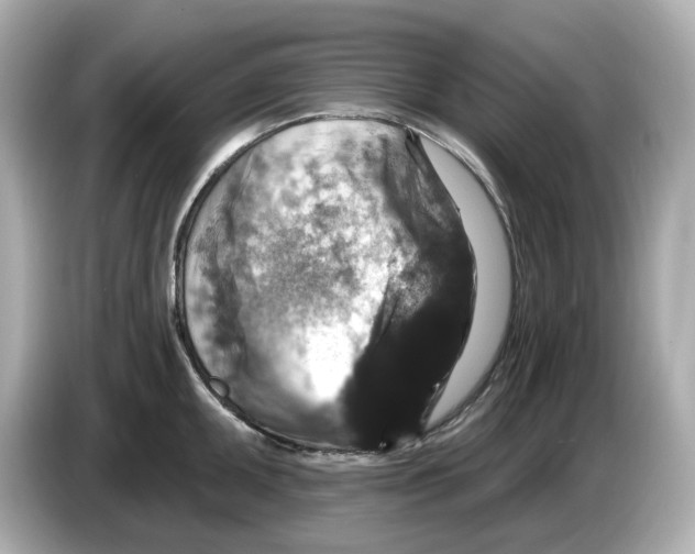 X0000085761095200704091330