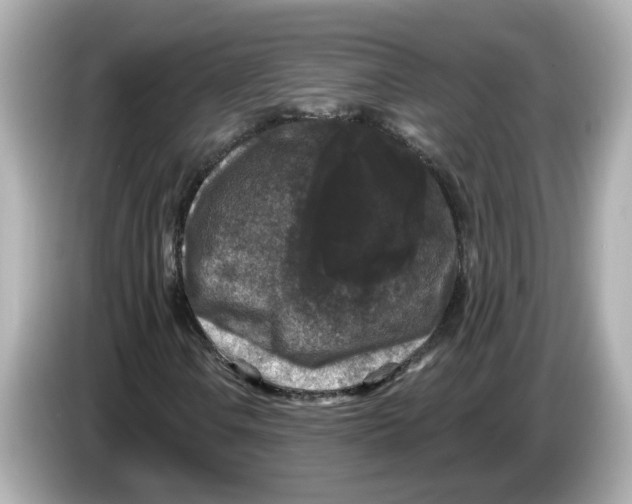 X0000085761106200704091329