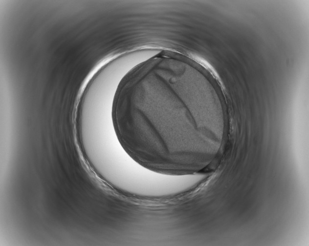 X0000085761138200704091329