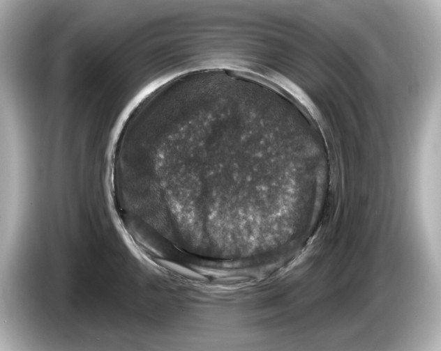 X0000085761144200704091329