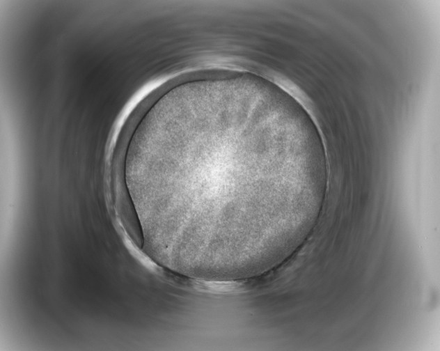 X0000085761152200704091330