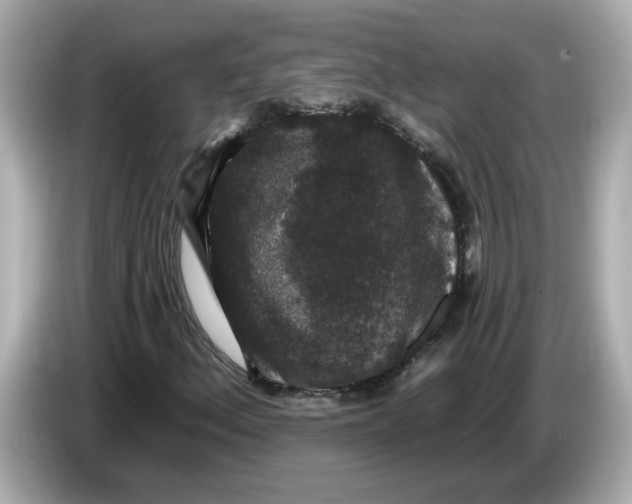 X0000085761156200704091329