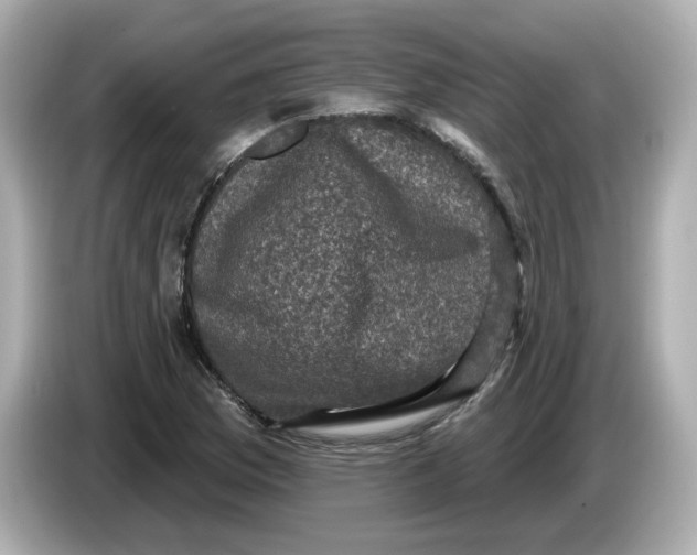 X0000085761169200704091329