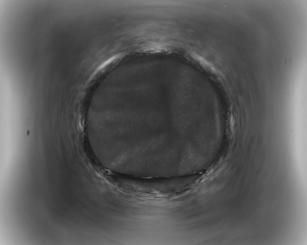 X0000085761206200704091328