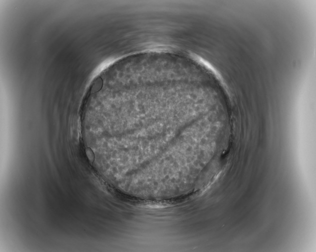 X0000085761267200704091328