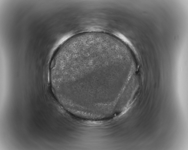 X0000085761269200704091328