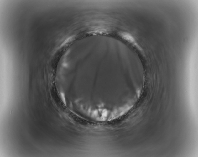 X0000085761399200704091326