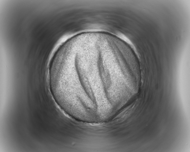 X0000085761472200704091325