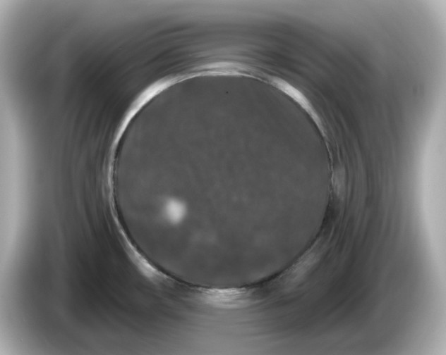 X0000085761482200704091325