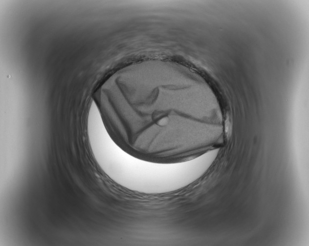 X0000085761492200704091325