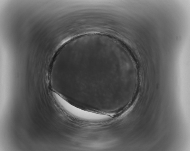 X0000085761497200704091325