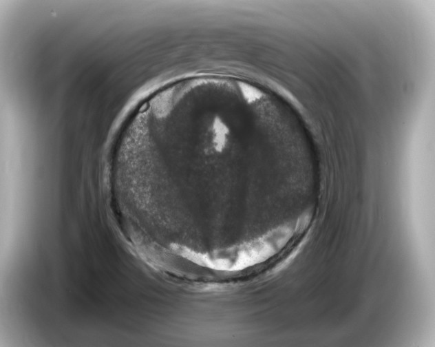 X0000085761506200704091325