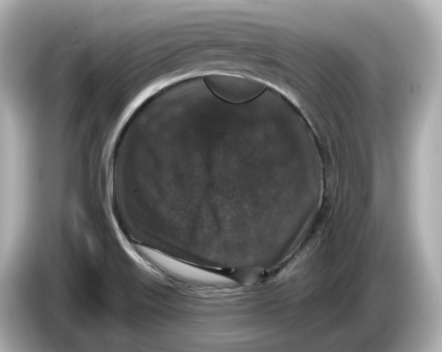 X0000085761515200704091325