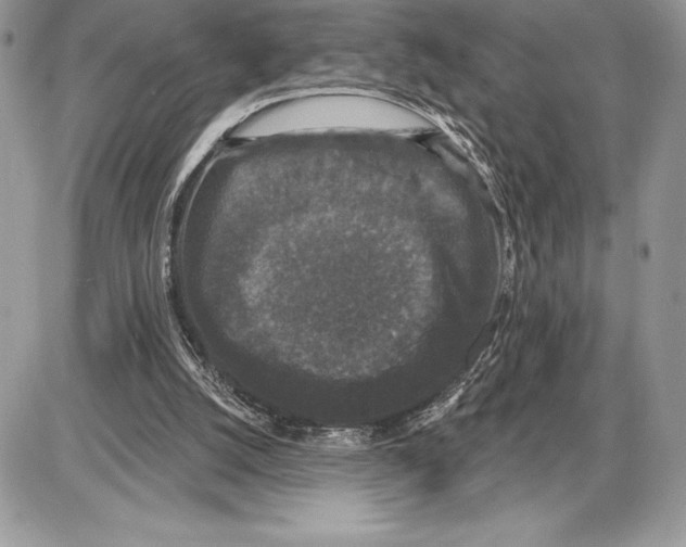 X0000085760056200704131748