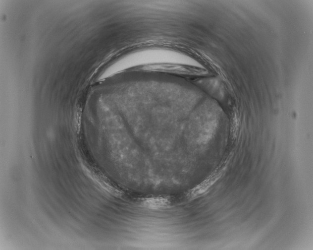 X0000085760168200704131747