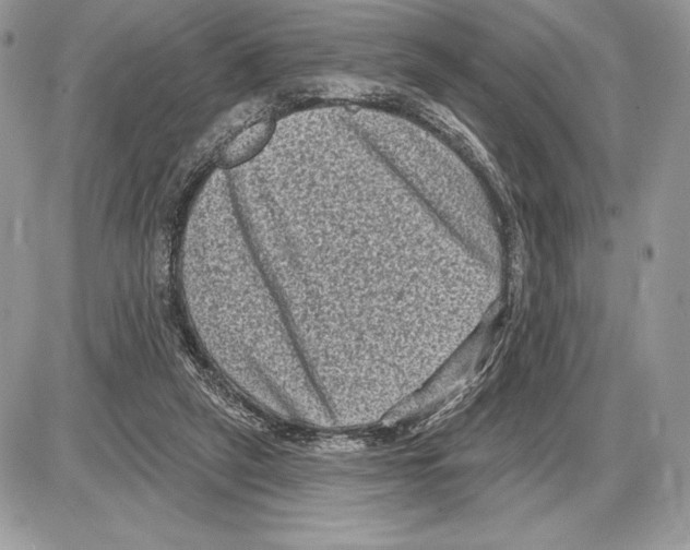X0000085760257200704131745