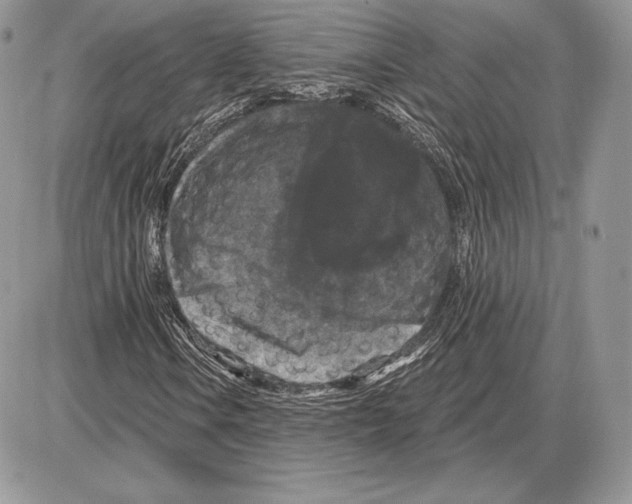 X0000085761106200704131730