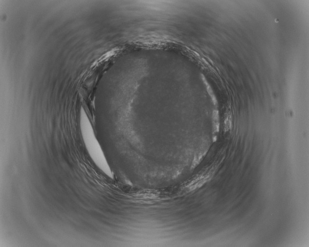 X0000085761156200704131730