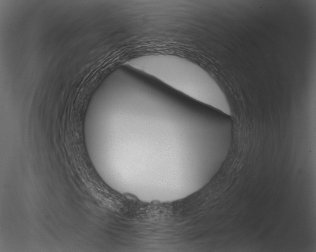 X0000085770865200703160930