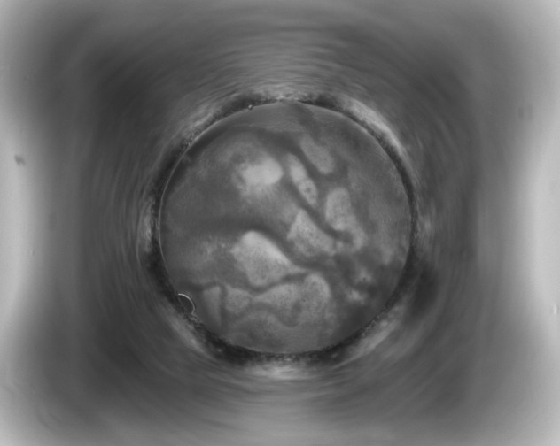 X0000085770065200703161152