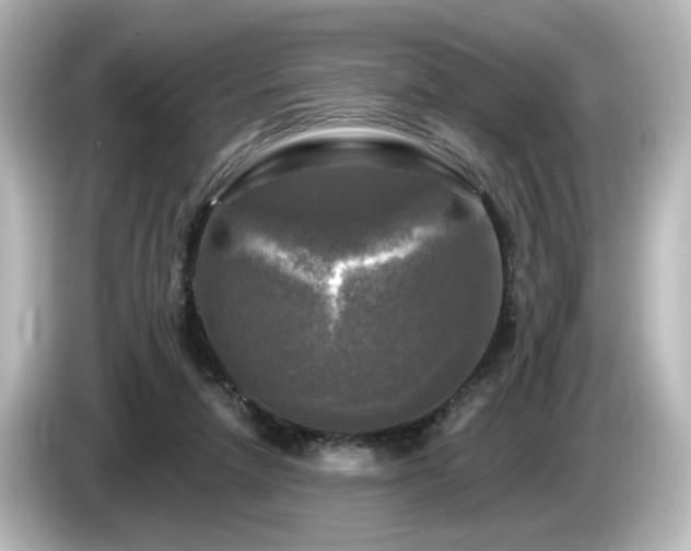 X0000085770258200703161149