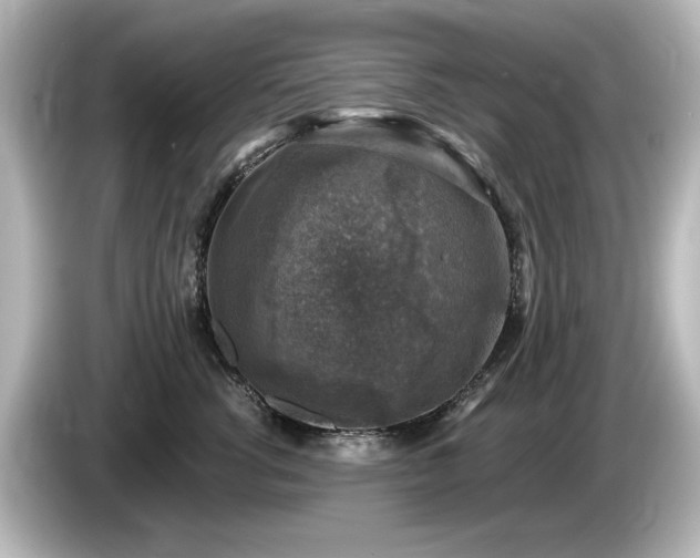 X0000085770762200703161143