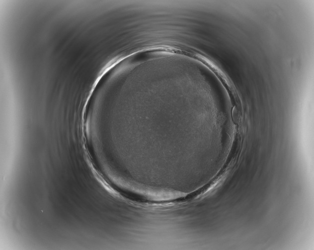 X0000085770858200703161141