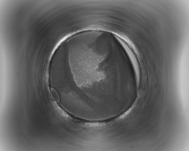 X0000085770896200703161140