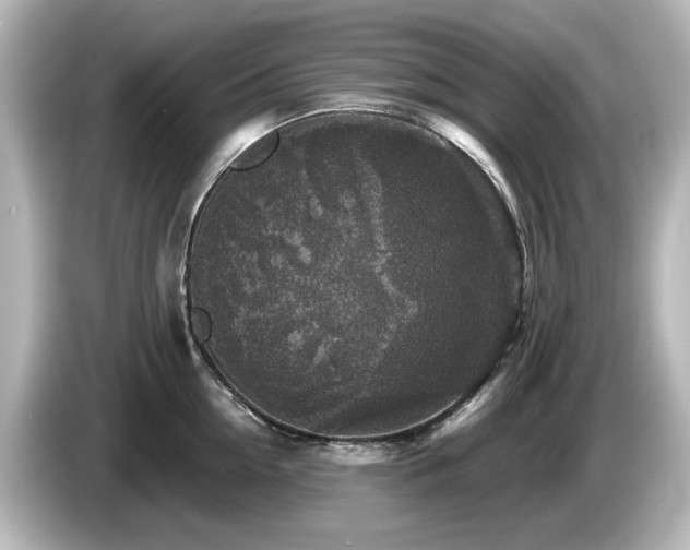 X0000085770954200703161140