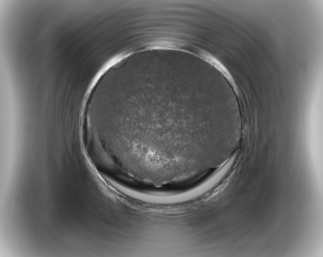 X0000085771146200703161136