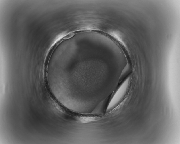 X0000085771173200703161135