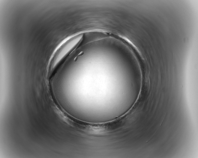 X0000085771460200703161130