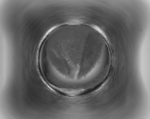X0000085771477200703161130
