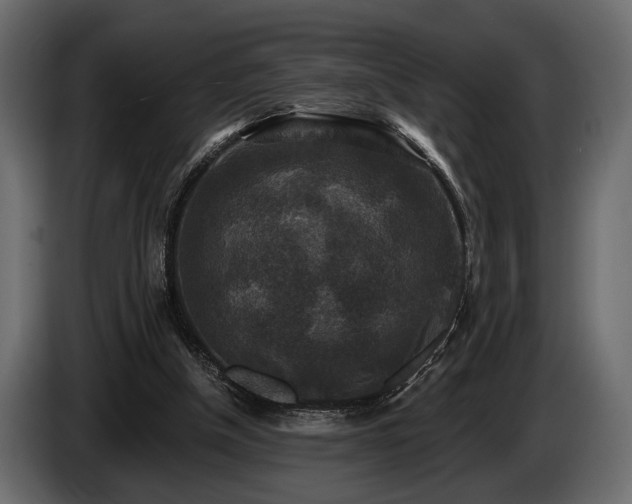 X0000085770154200703231231