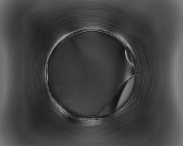 X0000085771084200703231218