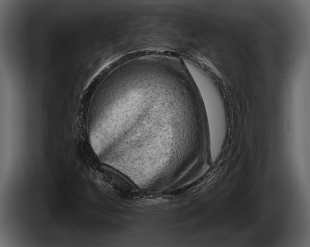 X0000085771256200703231215