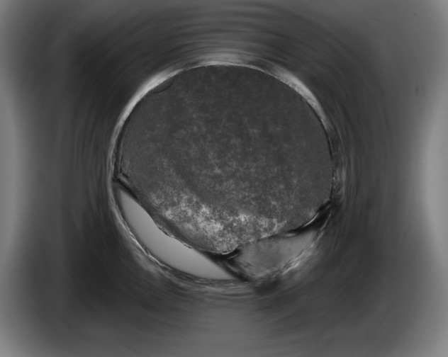 X0000085771146200703301357