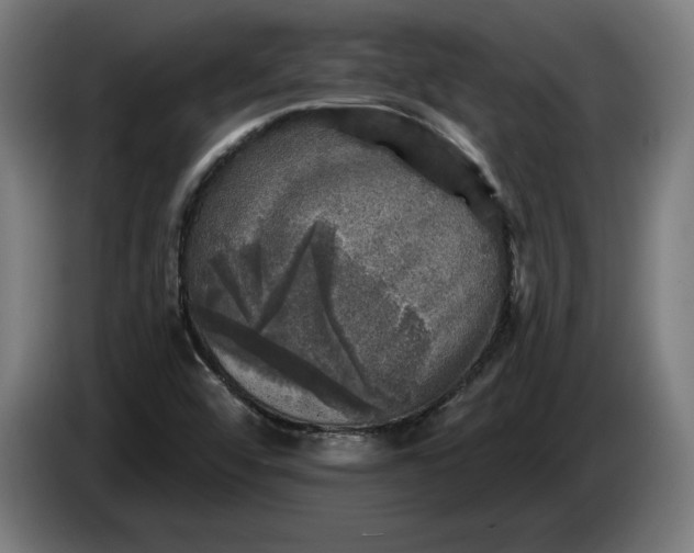 X0000085771456200703301352